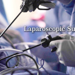 Laparoscopic Surgery Varanasi Hospital