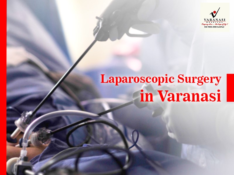 Laparoscopic surgery Varanasi