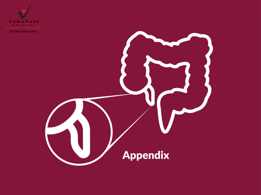 Appendix Surgery Varanasi