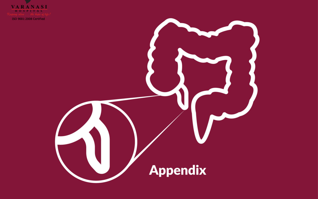 Appendix Surgery Varanasi