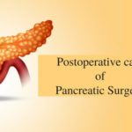 Pancreatic Surgery Varanasi