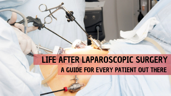 Laparoscopic Surgery Varanasi