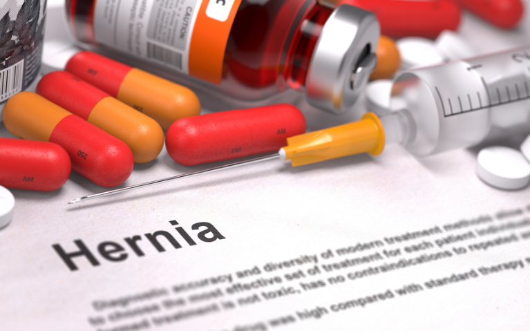 Hiatal Hernia: Symptoms, Causes, Diagnosis, And Treatment