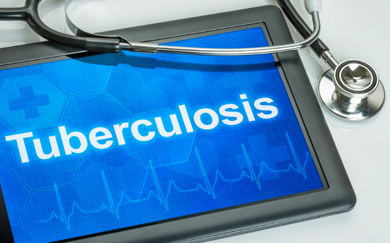 A Complete Guide On Tuberculosis By The Best Hospital In Varanasi