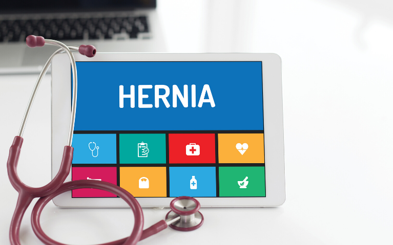Can Constipation Cause Hernia_ Is Hernia Surgery The Only Reliable Treatment_