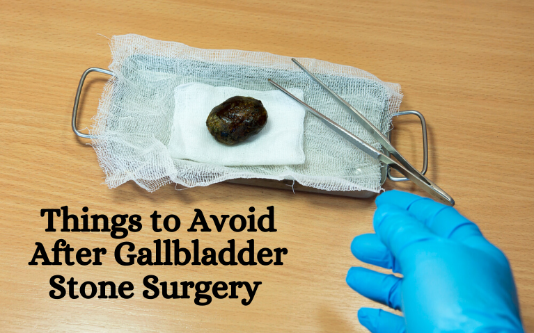 Varanasi Hospital’s Guide Things to avoid after gallbladder stone surgery